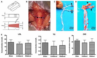 Bilateral Implantation of Shear Stress Modifier in ApoE Knockout Mouse Induces Cognitive Impairment and Tau Abnormalities